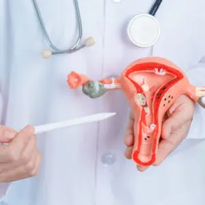 Chirurgie gynécologique