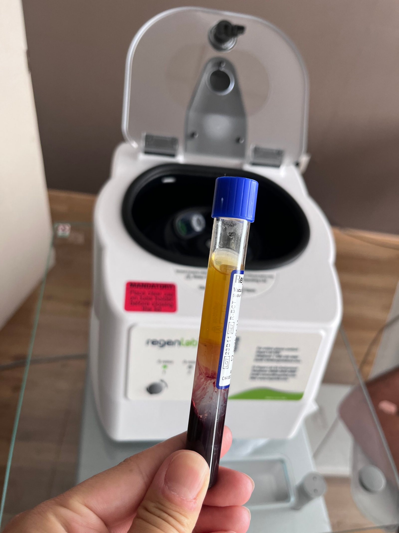 PRP - plasma riche en plaquettes